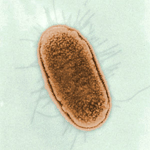 Treating E.Coli Poisoning Coriander Oil kills food borne organisms.