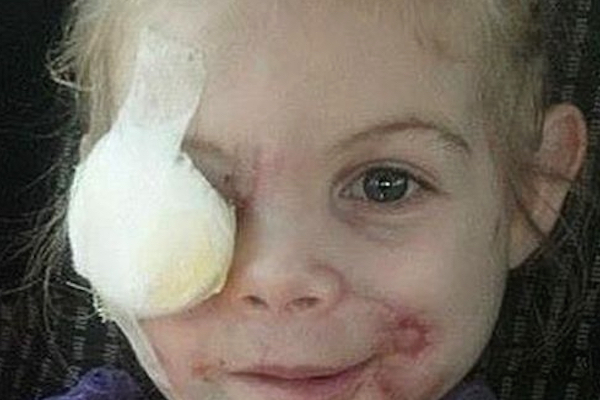 KFC Mauled Girl Hoax Graphic