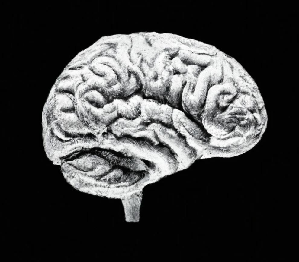 black and white picture of a brain with an injury